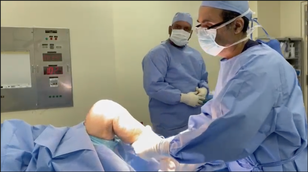 الحركة بعد عملية استبدال مفصل الركبة